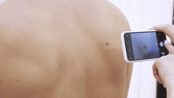 Choosing the Right Dermatologist On the Way to Healthy Skin