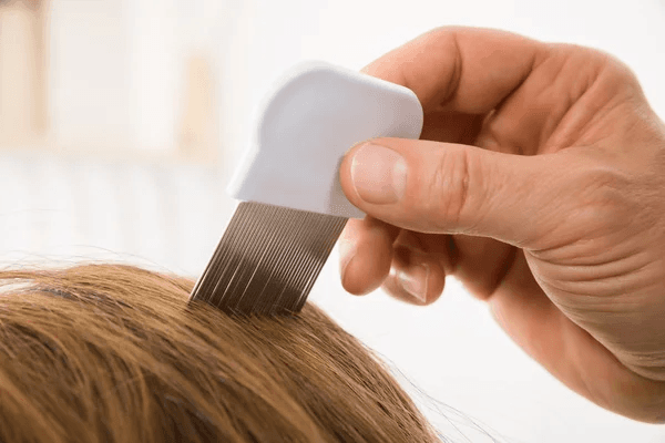 natural lice treatment